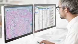 Digital Pathology and AI Innovation to Improve Cancer Care in the UK