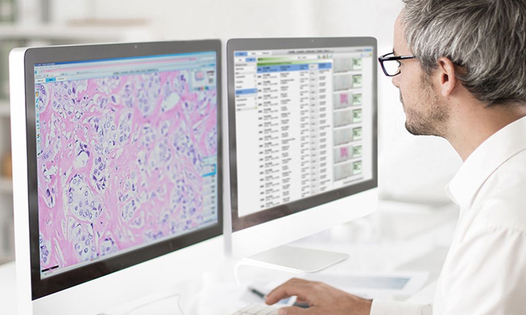 Digital Pathology and AI Innovation to Improve Cancer Care in the UK