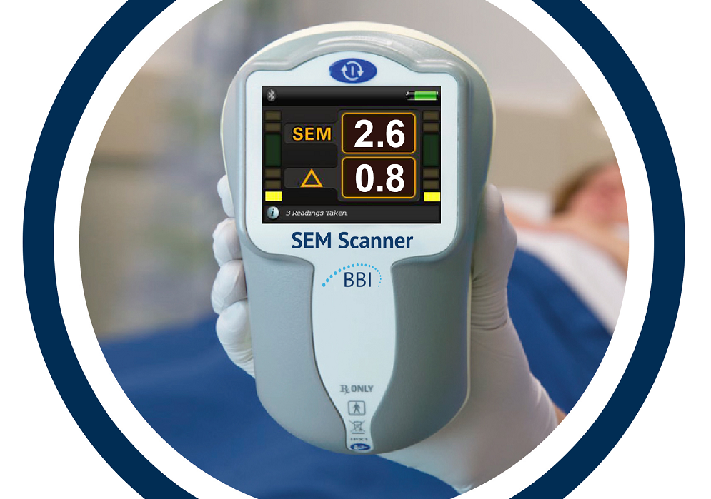 SEM Scanner Device for Objectively Assessing Patients at Risk of Pressure Ulcers Receives FDA Authorisation
