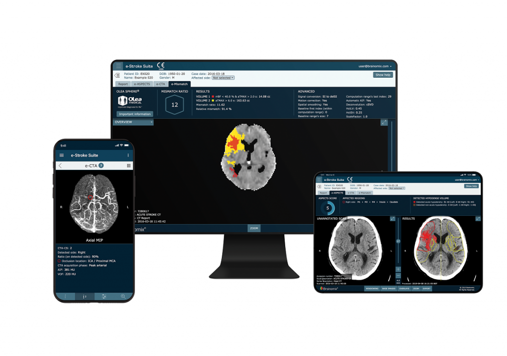 Collaboration to Accelerate Clinical Decision Making for Stroke Patients