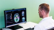 Investment will Support Combinostics to Scale Technology for Early Alzheimer's Diagnosis_WEB