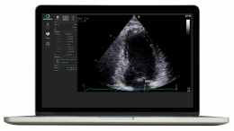 Ultromics Receives FDA Clearance for EchoGo Core Decision Support System