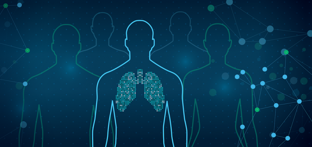 Imbio Pioneering Algorithms to offer NHS Organisations AI Support for Lung Condition Imaging