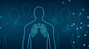 Imbio Pioneering Algorithms to offer NHS Organisations AI Support for Lung Condition Imaging