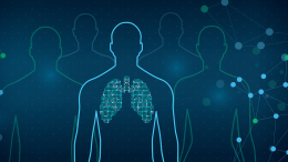 Imbio Pioneering Algorithms to offer NHS Organisations AI Support for Lung Condition Imaging