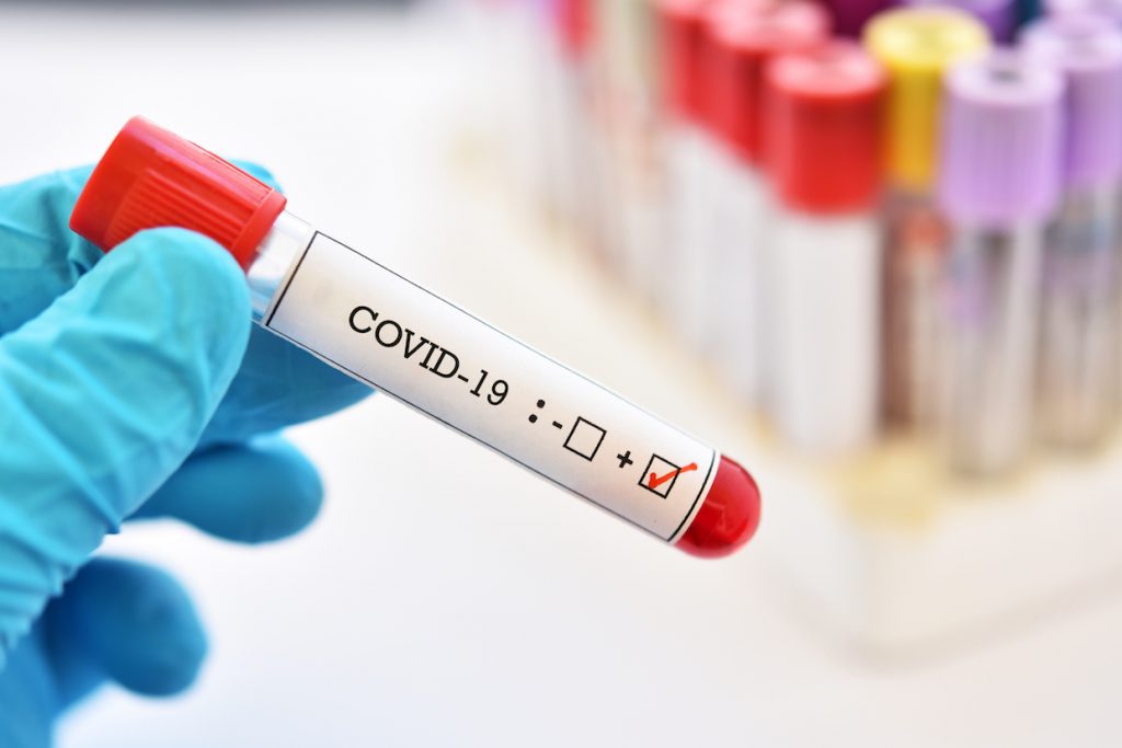 New Tool Helps Predict the Mortality Risk of Coronavirus
