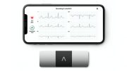ERT Offers First Patient-Administered ECG Assessment for Continuation of Clinical Trials during COVID-19