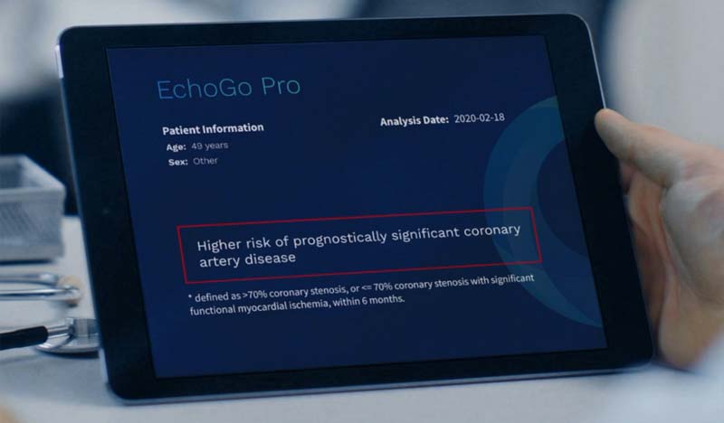 World-first AI Technology EchoGo Pro can Predict Heart Disease