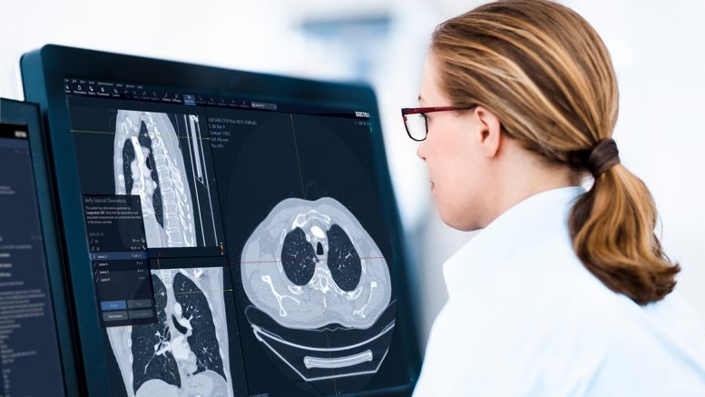Coping with Rising Demand - How Radiologists are Fighting Back with Tech - University Hospitals North Midlands