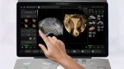 GE Healthcare Unveils AI-Enhanced Women’s Health Ultrasound