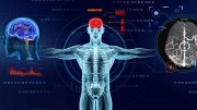 Wellbeing Software and GLEAMER Deliver AI-aided Diagnosis for X-Rays - Source Wellbeing Software
