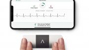 Solve.Care and AliveCor to Offer Coordinated Cardiac Monitoring and Telehealth Service