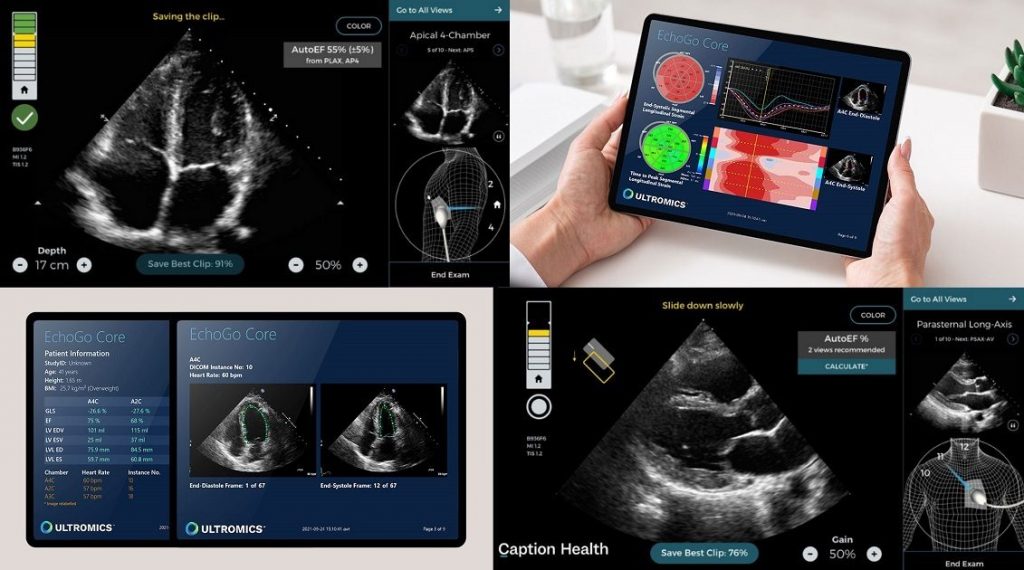 Caption Health and Ultromics Partner to Accelerate Heart Disease Detection