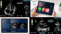 Caption Health and Ultromics Partner to Accelerate Heart Disease Detection