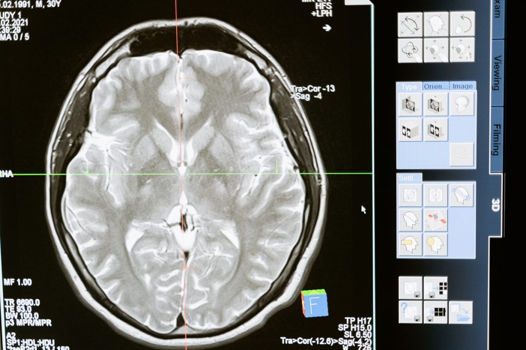 MedTech Trends for 2023