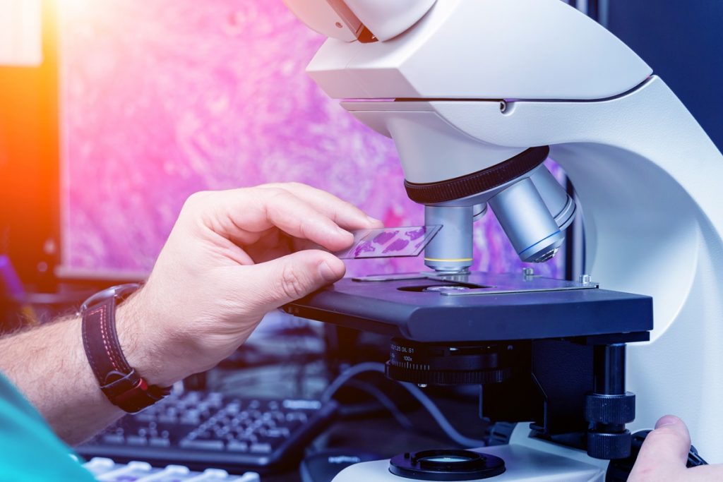 Harnessing AI to Revolutionise Pathology