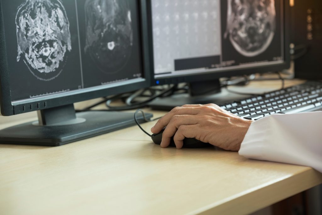 Transforming Radiology - How Autonomous AI is Reshaping the Field