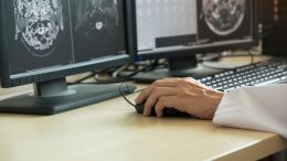 Transforming Radiology - How Autonomous AI is Reshaping the Field