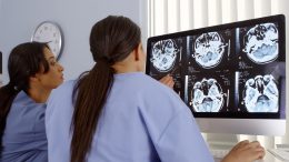 How can NHS Diagnostic Imaging Adopt AI more quickly