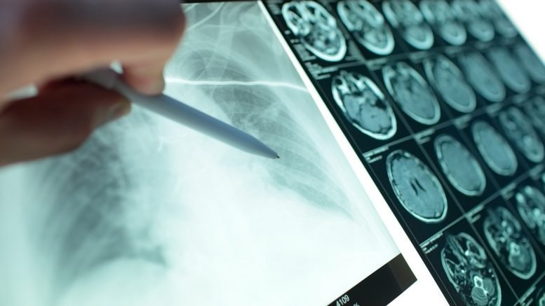 Barts Health takes ‘Giant Step’ for Medical Research with Sectra